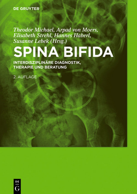 Spina bifida main product photo