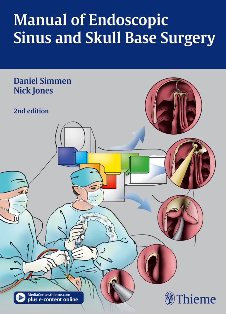 Manual of Endoscopic Sinus Surgery main product photo