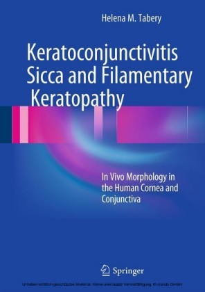 Keratoconjunctivitis Sicca and Filamentary Keratopathy