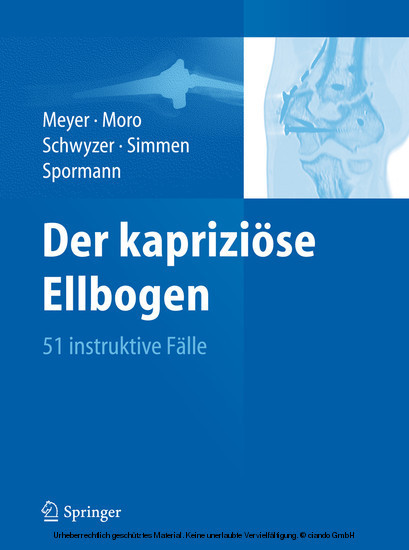 Der kapriziöse Ellbogen main product photo