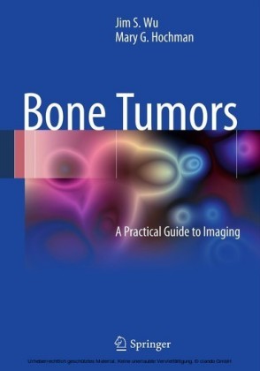 Bone Tumors
