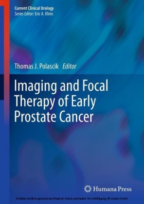 Imaging and Focal Therapy of Early Prostate Cancer