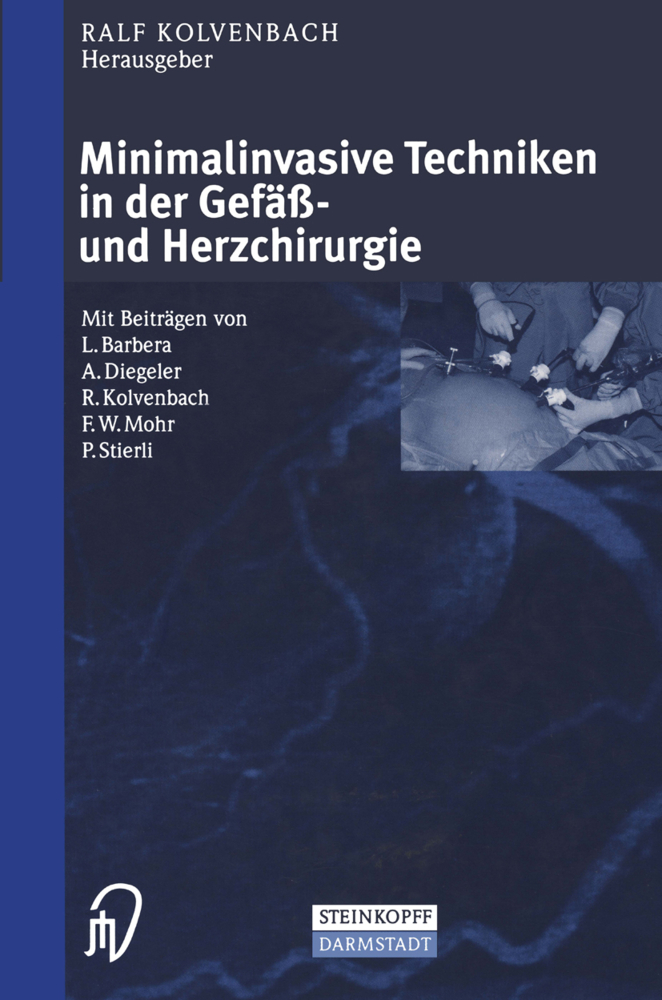 Minimalinvasive Techniken in der Gefäß- und Herzchirurgie main product photo