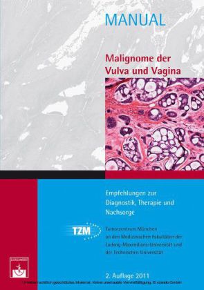 Malignome der Vulva und Vagina