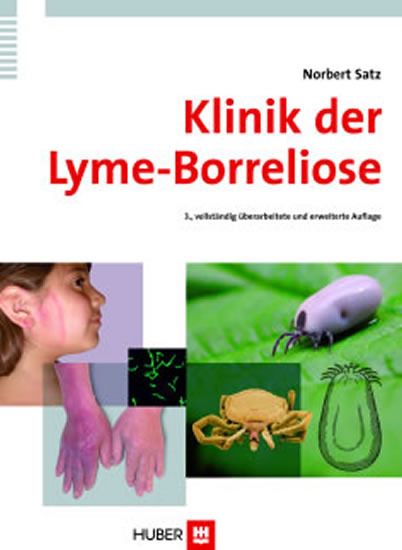 Klinik der Lyme-Borreliose main product photo