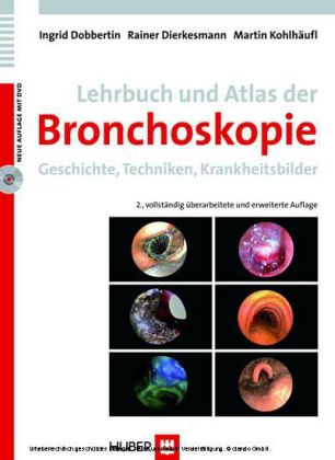 Dobbertin: Lehrbuch und Atlas der Bronchoskopie, 2. Auflage