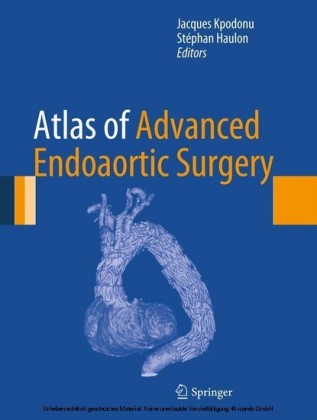 Atlas of Advanced Endoaortic Surgery