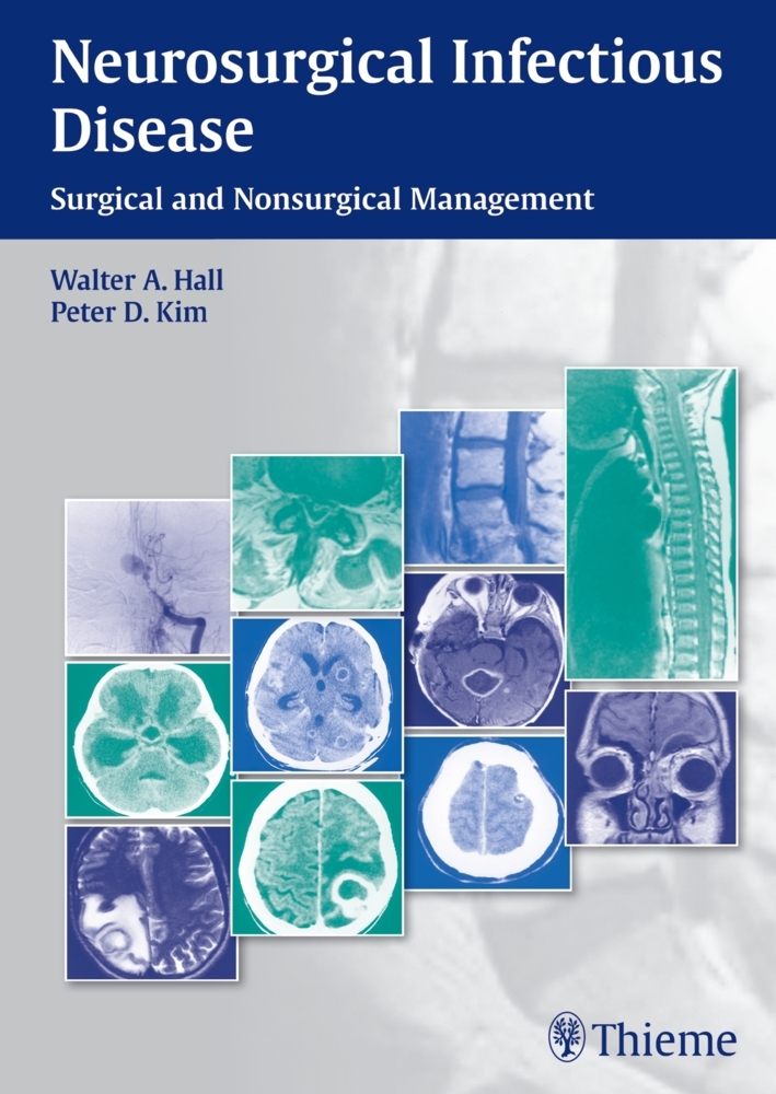 Neurosurgical Infectious Disease main product photo
