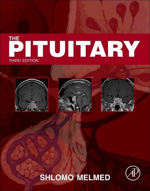 The Pituitary main product photo
