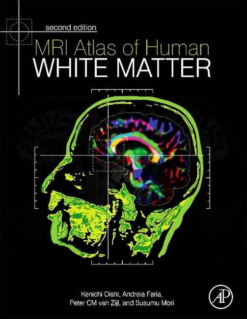 MRI Atlas of Human White Matter main product photo