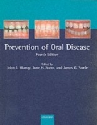 Prevention of Oral Disease