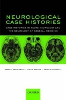 Neurological Case Histories Case Histories in Acute Neurology and the Neurology of General Medicine main product photo