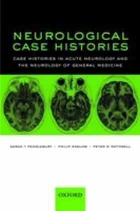 Neurological Case Histories Case Histories in Acute Neurology and the Neurology of General Medicine