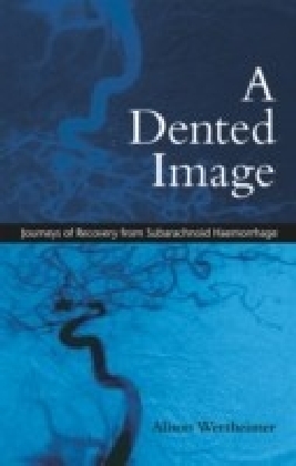 Dented Image