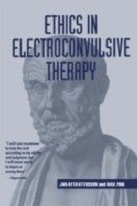 Ethics in Electroconvulsive Therapy