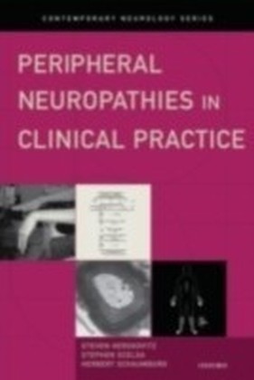 Amyotrophic Lateral Sclerosis