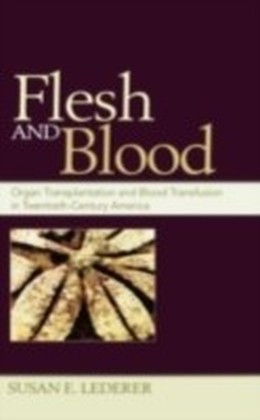 Flesh and Blood Organ Transplantation and Blood Transfusion in 20th Century America