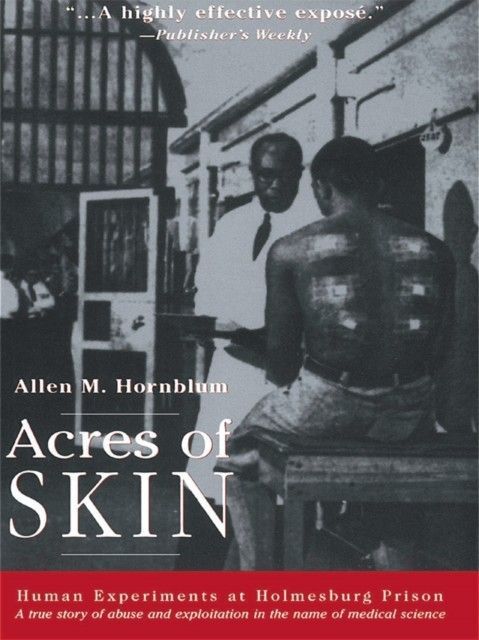 Acres of Skin main product photo