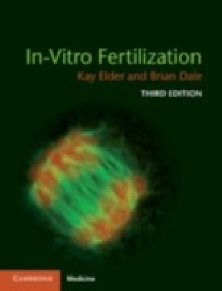 In-Vitro Fertilization main product photo