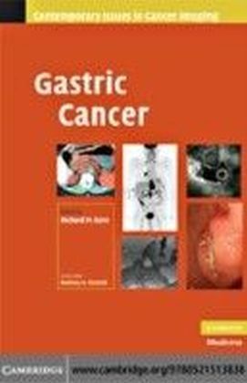 Gastric Cancer