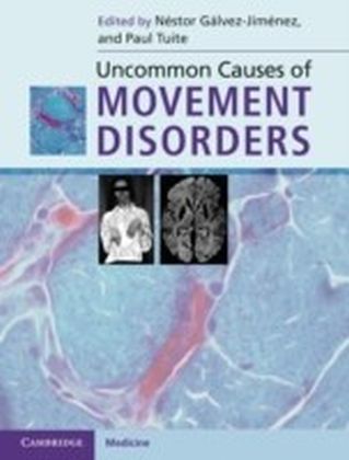 Uncommon Causes of Movement Disorders