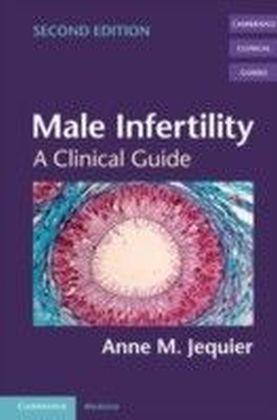 Male Infertility