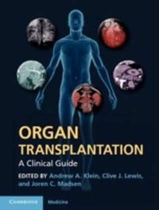Organ Transplantation