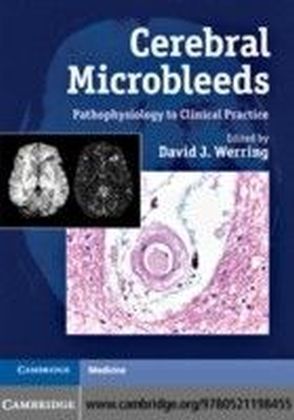 Cerebral Microbleeds
