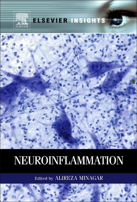 Neuroinflammation main product photo