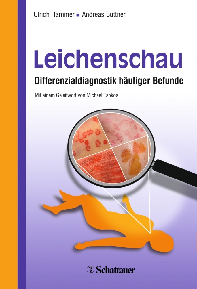 Leichenschau main product photo