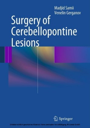 Surgery of Cerebellopontine Lesions
