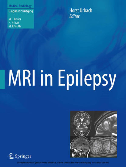 MRI in Epilepsy main product photo