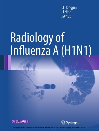 Radiology of Influenza A (H1N1) main product photo