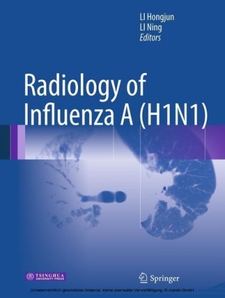 Radiology of Influenza A (H1N1)
