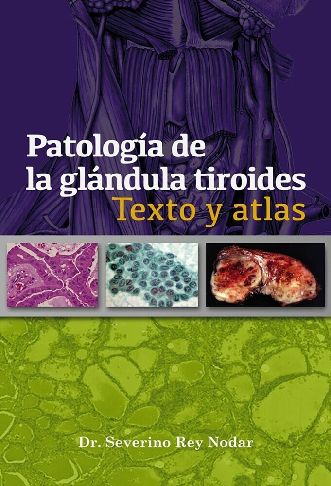 Patología de la glándula tiroides main product photo