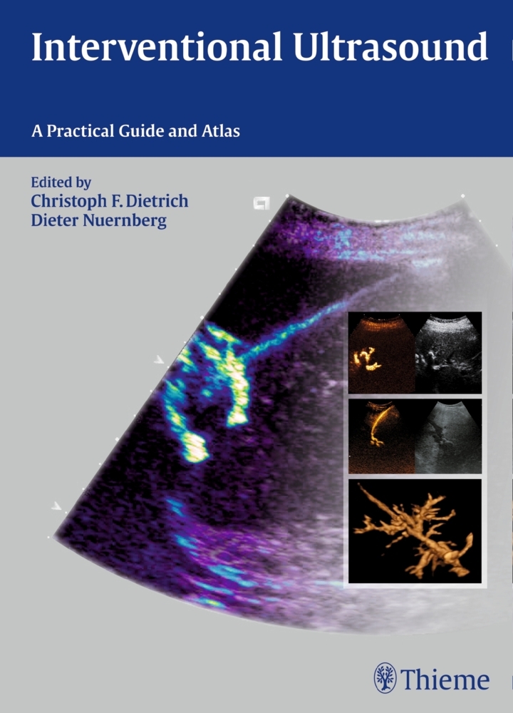 Interventional Ultrasound main product photo