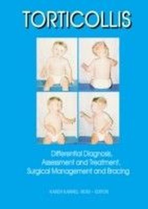 Torticollis