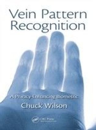 Vein Pattern Recognition