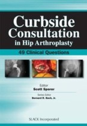Curbside Consultation in Hip Arthroplasty main product photo