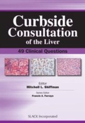 Curbside Consultation of the Liver main product photo