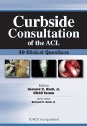 Curbside Consultation of the ACL