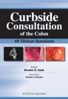 Curbside Consultation of the Colon
