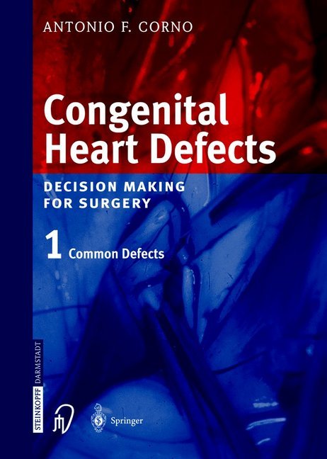 Congenital Heart Defects main product photo