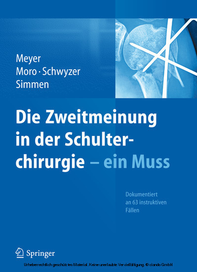 Die Zweitmeinung in der Schulterchirurgie - ein Muss main product photo
