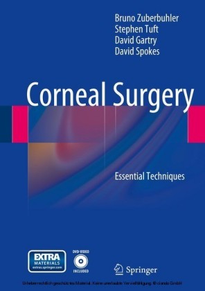 Corneal Surgery