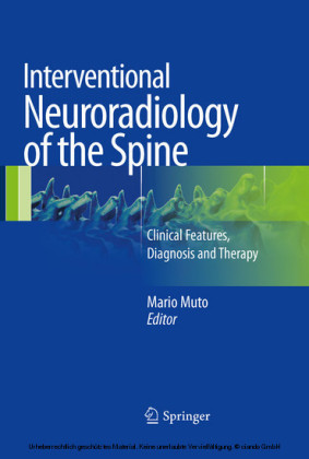 Interventional Neuroradiology of the Spine