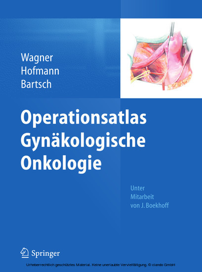 Operationsatlas Gynäkologische Onkologie main product photo