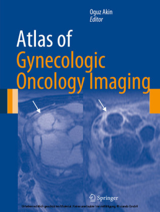 Atlas of Gynecologic Oncology Imaging