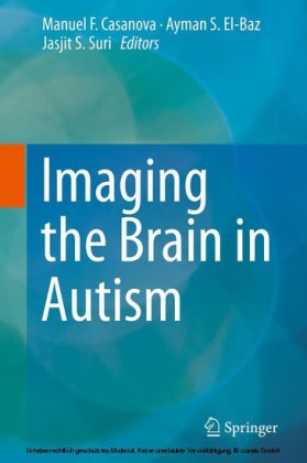 Imaging the Brain in Autism