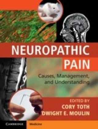 Neuropathic Pain main product photo